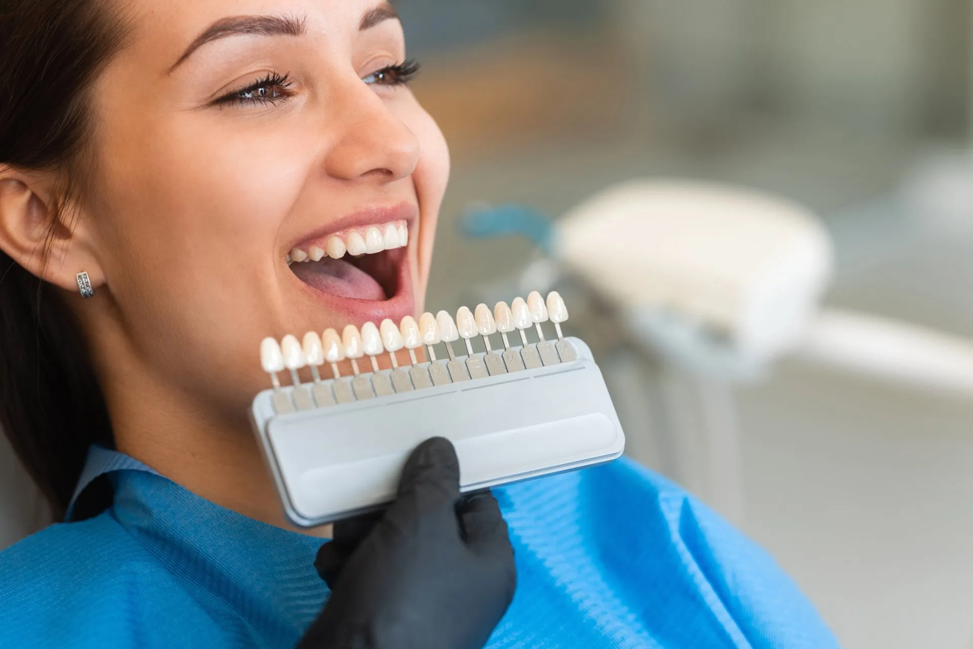 Matching a veneer shade against a patient's teeth